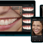 Diseño de sonrisa IA